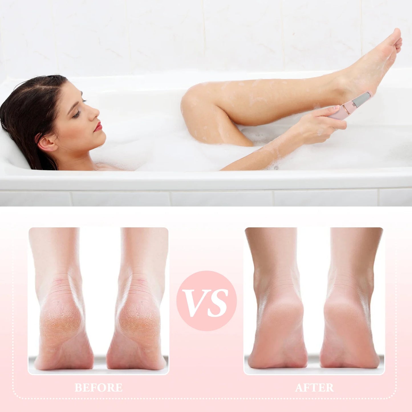 Pedicure Tool Electric Foot Scrubber Exfoliating Portable Files Feet Callus Remover Pink